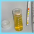 Тест-полоски на ацетон (кетоновые тела) в моче